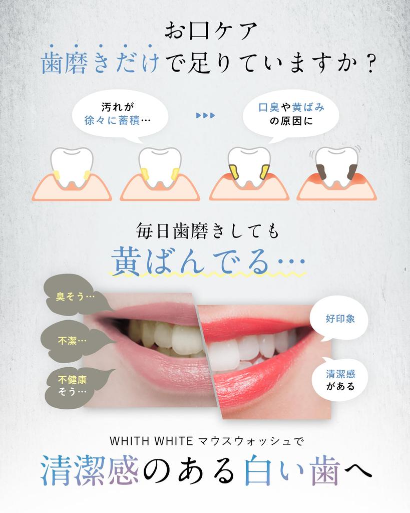 the dirt WHITH WHITE Mouthwash Mild Breath 300ml [See removed] [Refreshing Flavor] Mouthwash, Freshener,