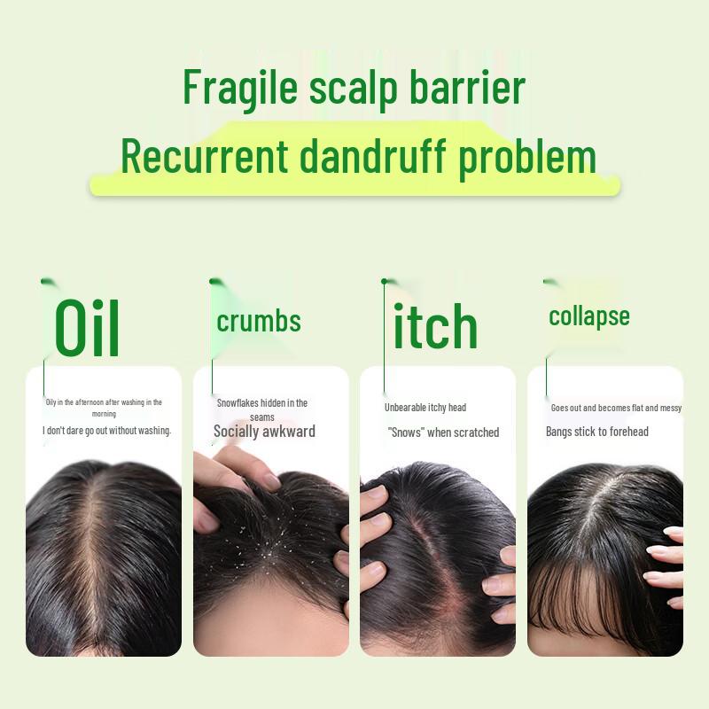 Super Mild Anti-Dandruff & Soothing Shampoo Set