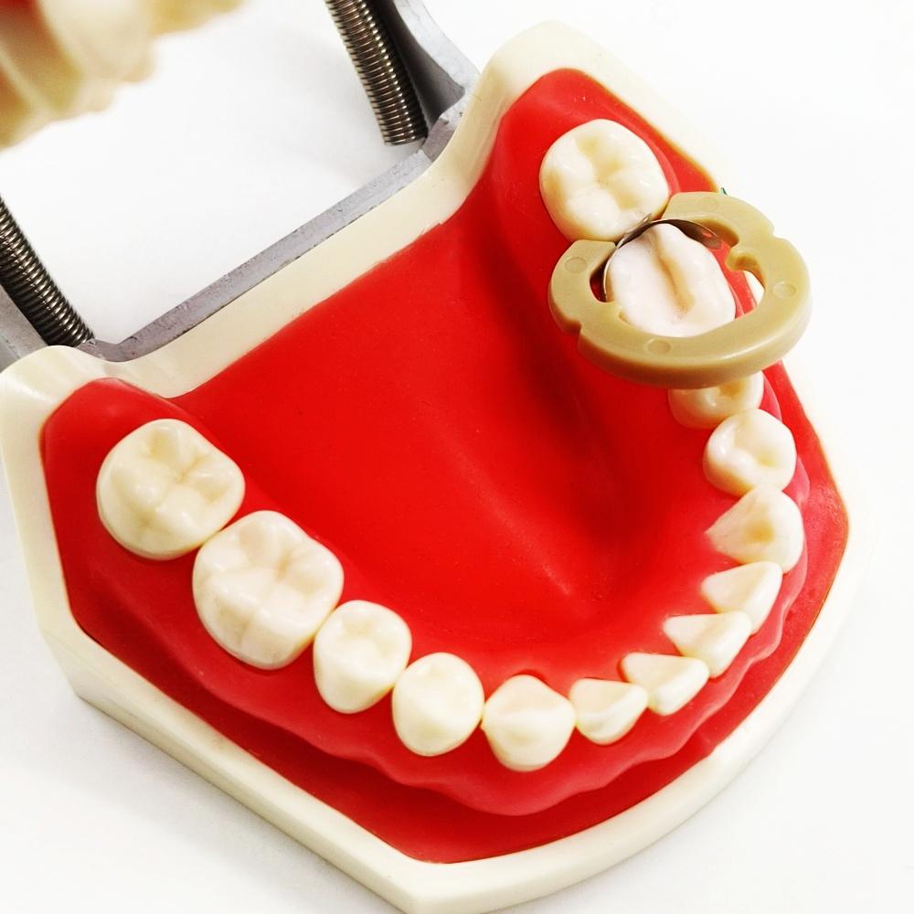 80pcs New Dental Sectional Contoured Metal Matrices Matrix Set Matrix Bands  Rubber Wedges  with Add-on Wedges Dentist Materials