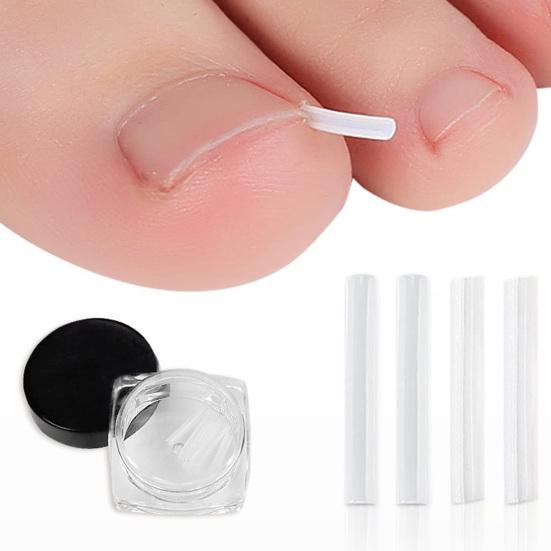 1 комплект, набор для коррекции ногтей на ногах, аксессуары для ухода без клея, премиум-корректор для маникюрного салона