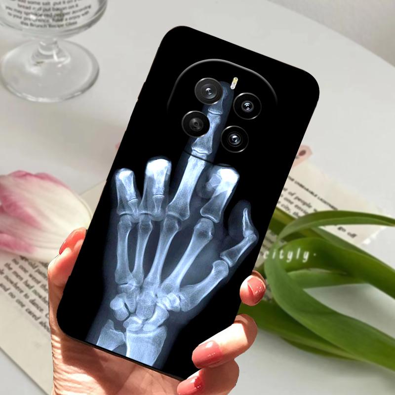 Чехол для Honor Magic7 5G Capa Magic 7 Ударопрочный Силиконовый Защитный Задняя крышка телефона Для Huawei Honor Magic7 Pro Бамперные оболочки