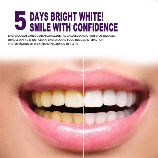 3ml Teeth Whitening Pen Safe Simple Operation Non-irritating Effective Portable Anti-pigmentation Eco-friendly Teeth Whitening Essence Pen for Home