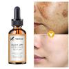 Multi Function Face Serum Argan Oil Anti Freckle Anti Wrinkle Moisturizing Removeal Scars Whiten Brighten Skin Care Essence