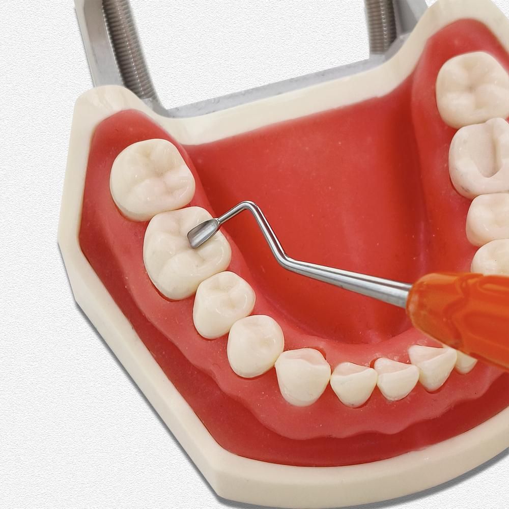 Инструменты для эстетической реставрации зубов Replica Posterior для упрощения моделирования зубов Окклюзионный инструмент для моделирования задних зубов из силикона