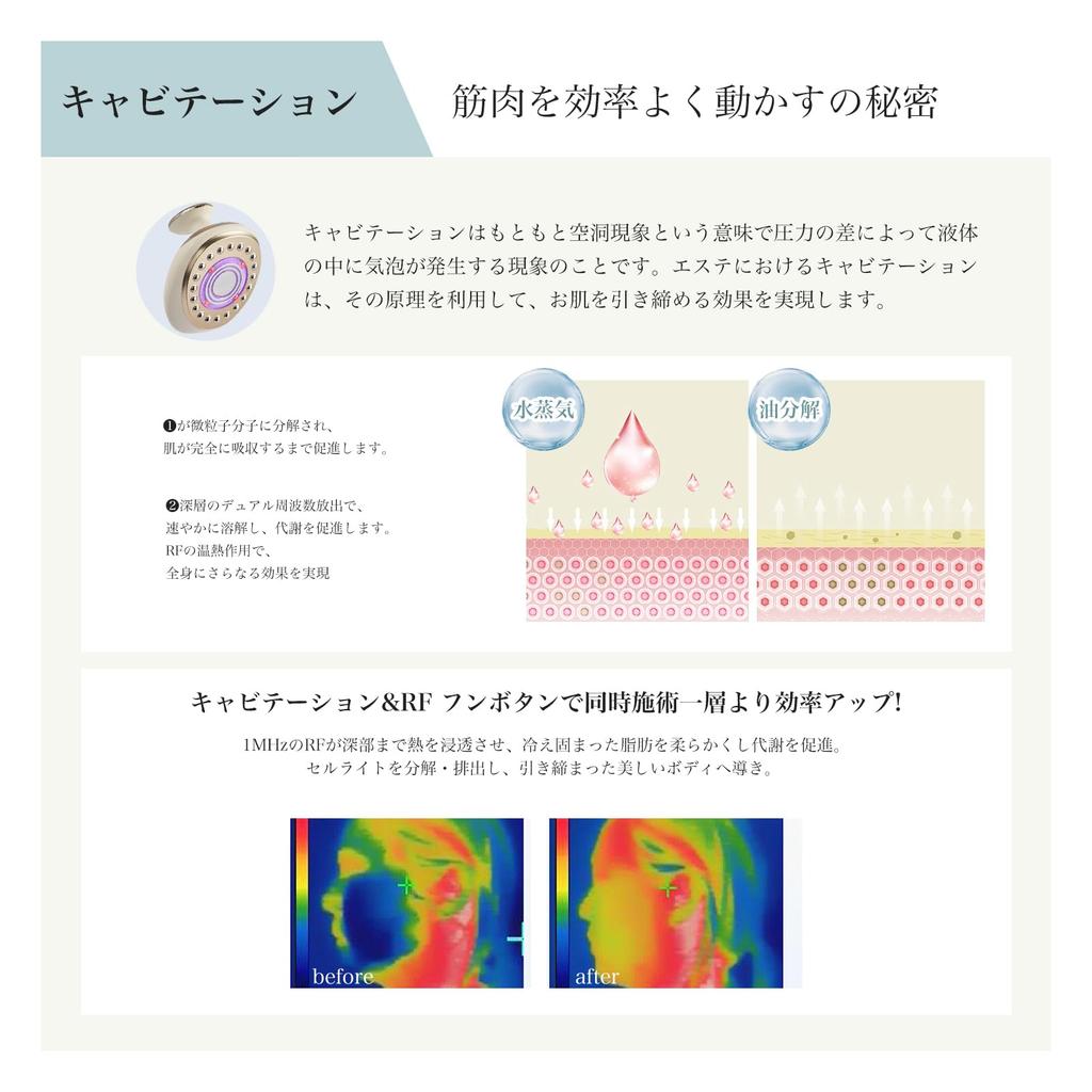 Yete Facial Beauty Body Beauty Composite Beauty Ultrasonic 5 Levels of Intensity EMS Abdominal Muscle Upper Beauty Full Body Beauty Home Beauty Beauty