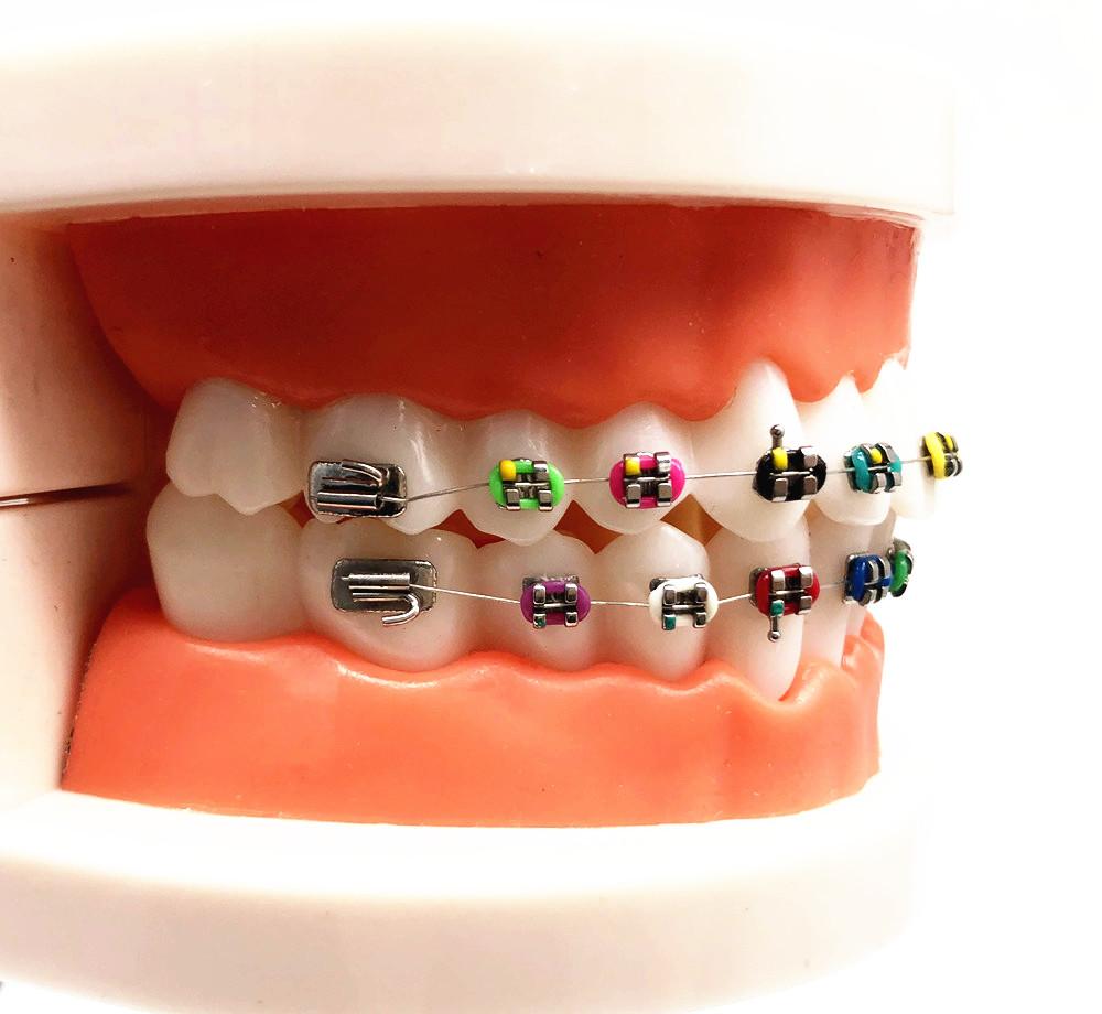 1 шт., стоматологическая модель для ухода за полостью рта, стоматологическая ортодонтическая модель для общения с пациентом, модель для исследования стоматолога