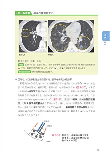 How To Write a CT Image Reading Report? - Basic Knowledge of Anatomy and Findings, and Examples of Reports for Common Diseases