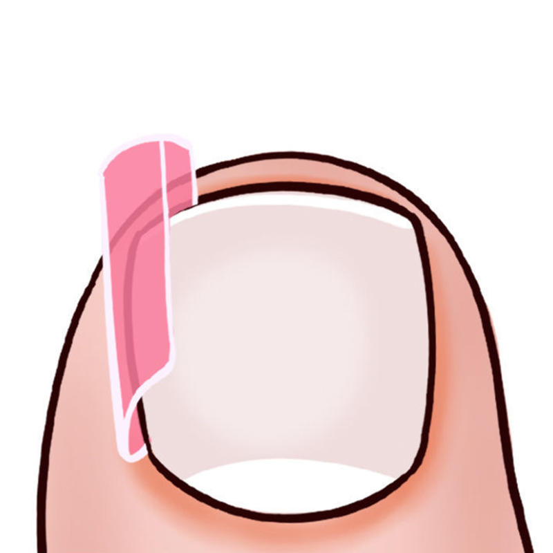 Набор из 50 шт. корректирующих подушечек для вросшего ногтя, ортез для ногтя, корректирующие полоски, бандаж для женщин и мужчин