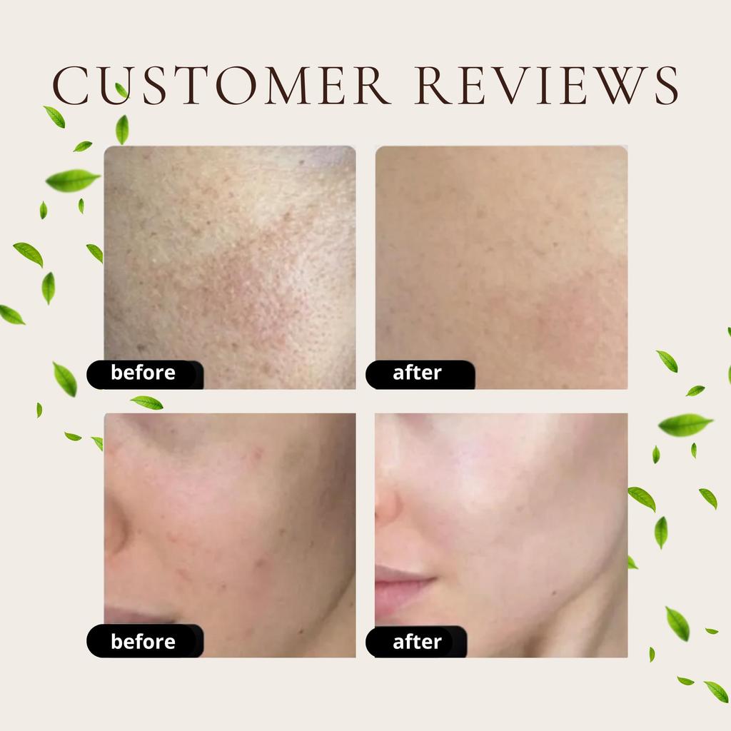 Home-Peel Jessner's peel, 10ml. / Пилинг Джесснера pН 3.5, 10мл.