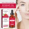 Organic Rosehip Oil, Intensive Nourishment, Improves Appearance of Scars, Stretch Marks, Fine Lines, & Wrinkles