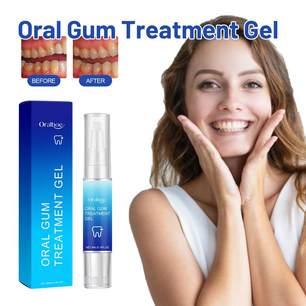 Gingival Gel Relieves Swelling And Pain Of Gums Cleans Tooth Stains Tooth Yellows Fresh Breath Care  4ml