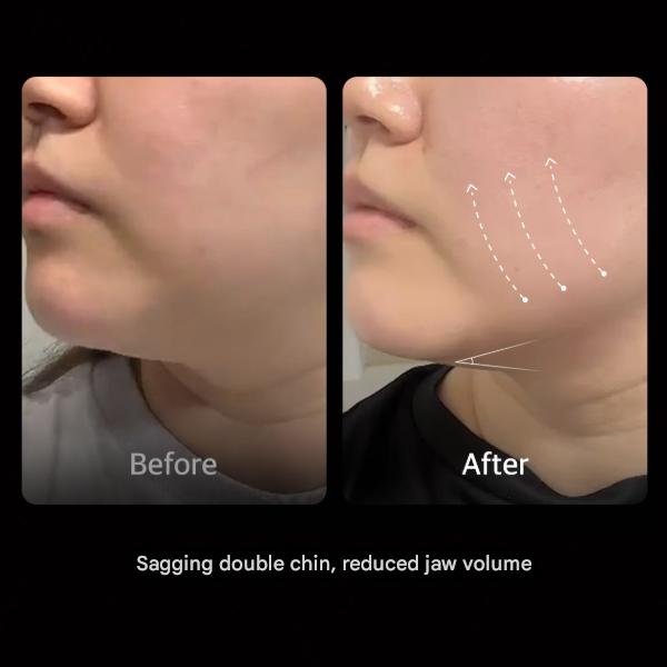 Medicube [AGE‑R] Высокоинтенсивный выстрел