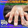 Растительный питательный бальзам для грубых потрескавшихся рук и ног - Не раздражает