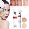 20g Whitening Freckle Removing Cream Melasma Anti Aging Skin Care Cream Facial Dark Wrinkles Ca S8W7