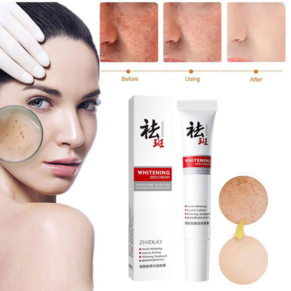 20g Whitening Freckle Removing Cream Melasma Anti Aging Skin Care Cream Facial Dark Wrinkles Ca S8W7