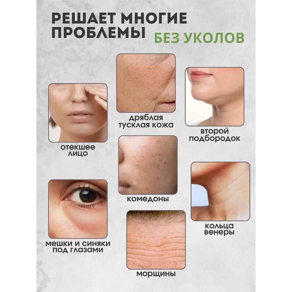 Микротоки Микротоковый массажер для лица RF-лифтинг