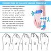 Kemei Paire de coussinets de correction avec attelle pour hallux valgus et oignon Soulagement de la douleur et correction [290]