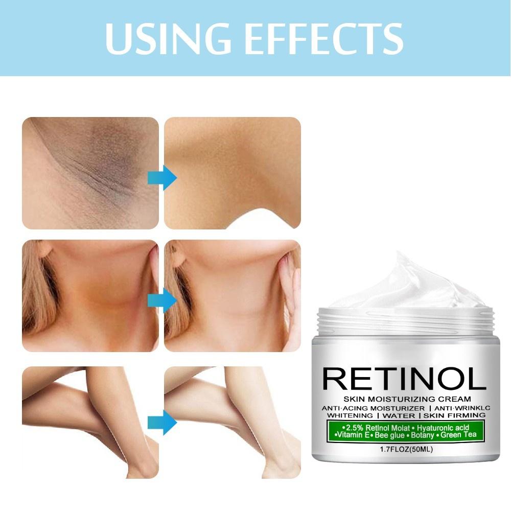 Красота Отбеливающий крем Отбеливающий крем для тела Осветляющий крем для подмышек Отбеливающий крем для подмышек Ноги Колени Частные части тела Белый