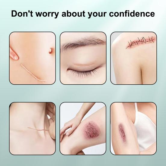 Силиконовые пластыри для рубцов, рулон ленты для рубцов, профессиональные мягкие полоски для рубцов после хирургических операций, келоидные рубцы, лечение угревой сыпи, силиконовый гелевый пластырь