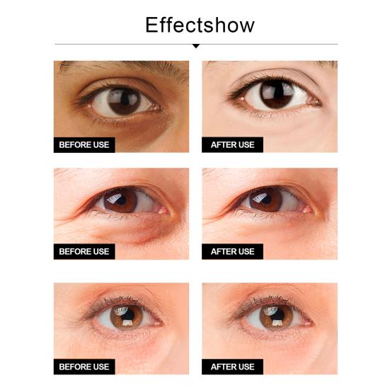 30 мл крем для глаз против старения, снимает усталость, без стимуляции, лифтинг, укрепляющий крем против отечности, крем для глаз для женщин