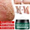 Newest Hand and Foot Skin Repairing Moisturizer Cream Anti-Chapping for Rough Dry and Cracked Chapped Feet Heel Repair Foot Cream