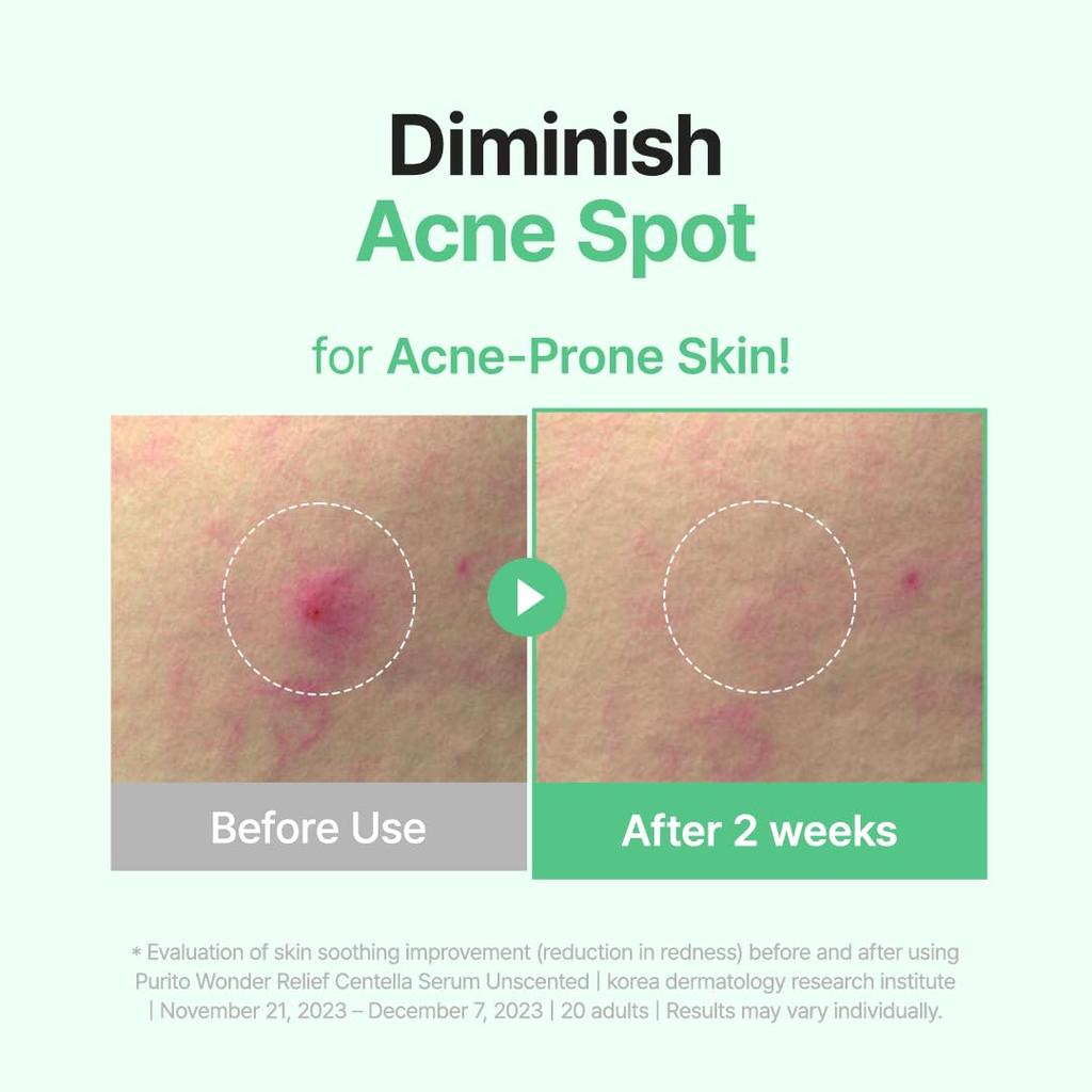 Purito Сыворотка Seoul Wonder Relief Centella без запаха 60 мл | Гипоаллергенная, успокаивающая и увлажняющая для чувствительной кожи