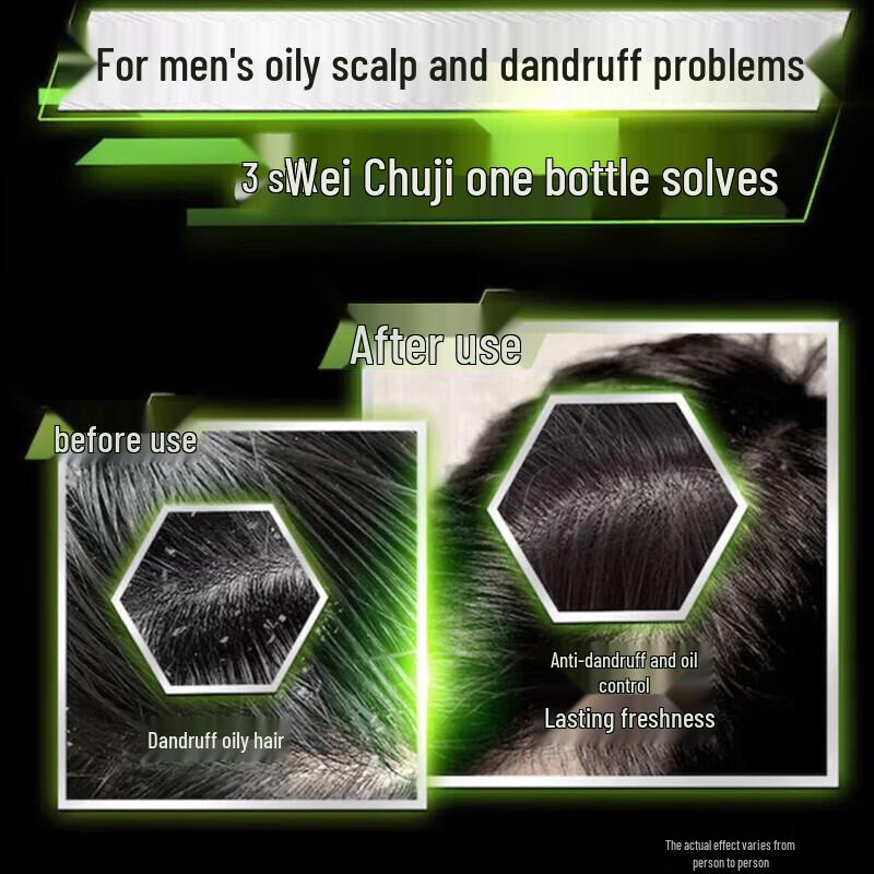 Clear Men Anti-Dandruff Shampoo