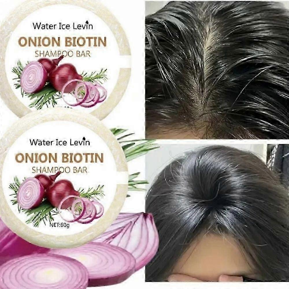 3pcs Onion and Biotin Shampoo Soap - 60g, Suitable for All Hair Types, Moisturizing and Smoothing, Rich in Rosemary Extract