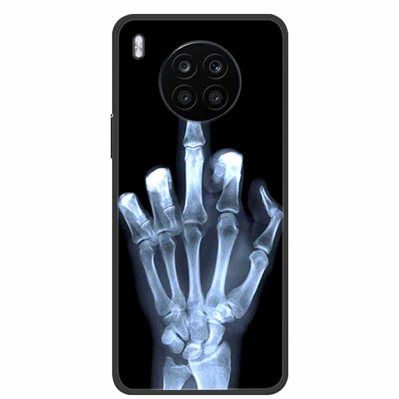 For Honor 50 Lite Case Shockproof Soft silicone TPU Back Cover For Huawei Honor 50 Lite Phone Cases Honor50 Lite Cute Cartoon