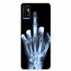 For ZTE Blade A71 Case Animals Bumper Silicone TPU Soft Cover Phone Case For ZTE Blade A71 A7030 Shockproof Cartoon Coque Funda