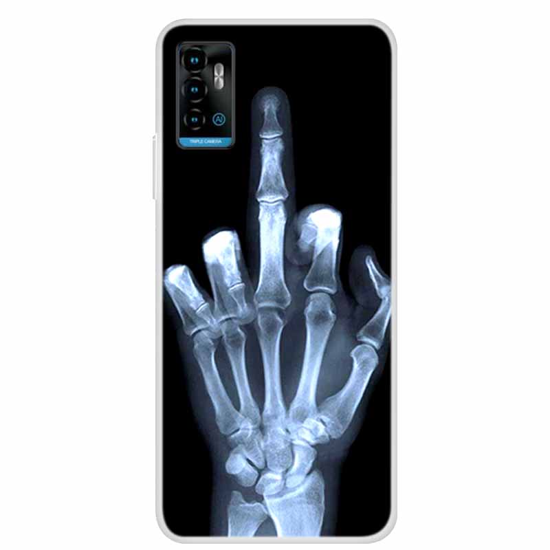 For ZTE Blade A71 Case Animals Bumper Silicone TPU Soft Cover Phone Case For ZTE Blade A71 A7030 Shockproof Cartoon Coque Funda