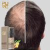 Fast Hair Growth Oil Anti-Hair Loss Ginger Essential Oil Treatment Serum Hair Care Products