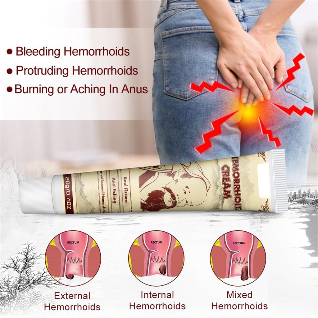Успокаивающая паста от геморроя, успокаивающая геморрой, подходит для мужчин и женщин, следует наносить пасту от геморроя