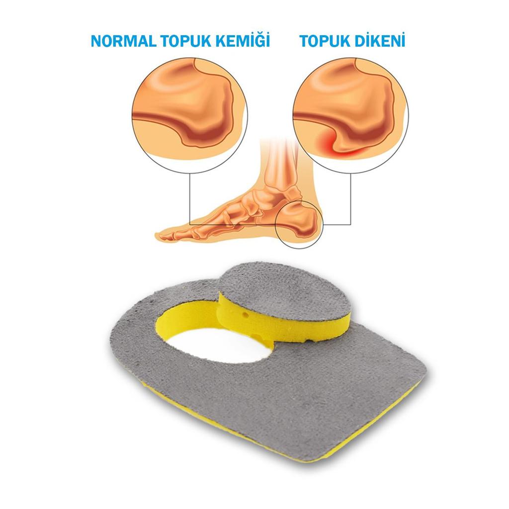 black deer Пяточная шпора (Эпин Хел) Антрацитовые стельки для пяточной шпоры