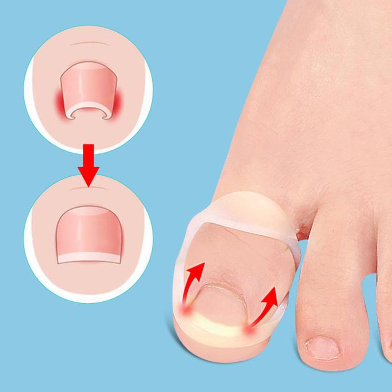 Силиконовый инструмент для коррекции вросшего ногтя, невидимое средство для лечения вросшего ногтя, эластичный выпрямляющий зажим, скоба, инструмент для педикюра