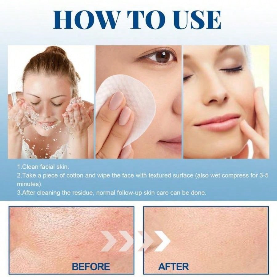 Гликолевая кислота + 30% удаление прыщей, хлопковые таблетки, контроль масла, сужение пор, увлажнение и увлажнение лица, очистка и восстановление закрытых прыщей.