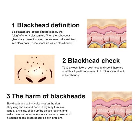 10 шт. средство для удаления черных точек и угрей на носу, наклейка для очистки пор, полоска для ухода за кожей