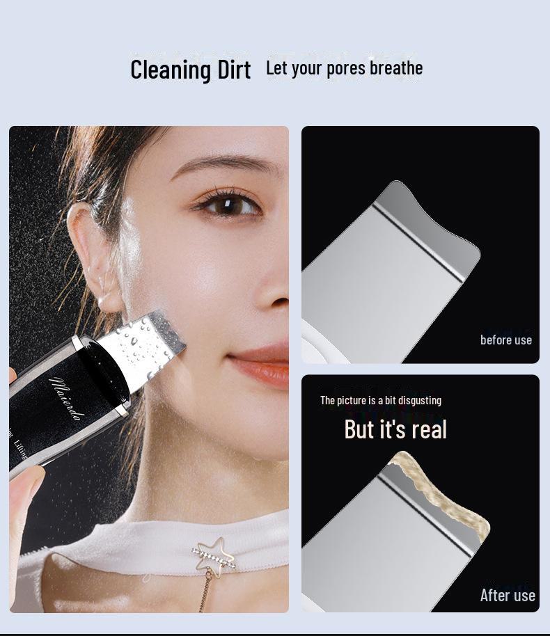 Ультразвуковой скребок для удаления черных точек - очиститель лица и средство для удаления прыщей с вибрацией для очистки пор и гладкой кожи