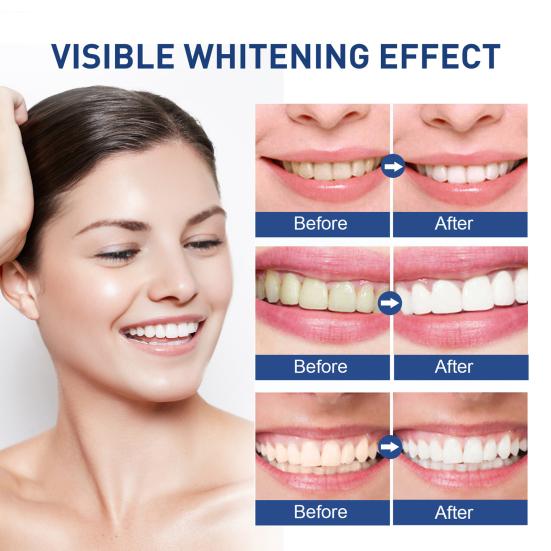 1/2Pcs 100G Whitening Toothpaste Freshening Breath Stain Removal Oral Health Enamel Protection Sensitive Teeth Cleaning Brightening Toothpaste
