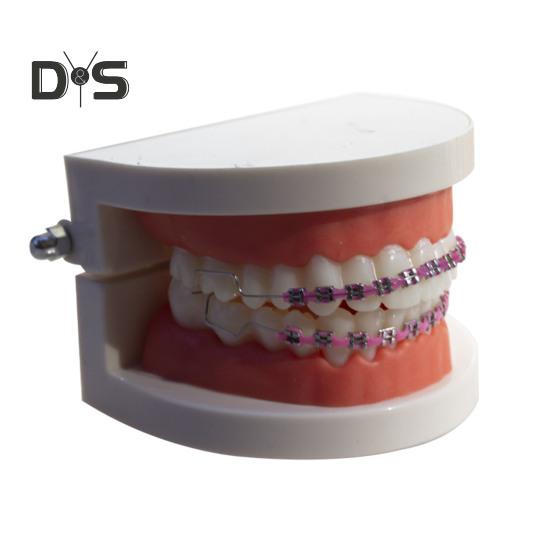 Temporary Tooth Decoration with Metal Wires Brackets Orthodontic Ligatures Orthodontists Explain Dental Students Practice Props