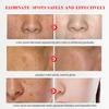 Face Whitening Freckle Cream Remove Melasma Cream Remove Dark Spots Melanin Melasma Remover Brighten Skin Anti-Aging Skin Lightening Cream