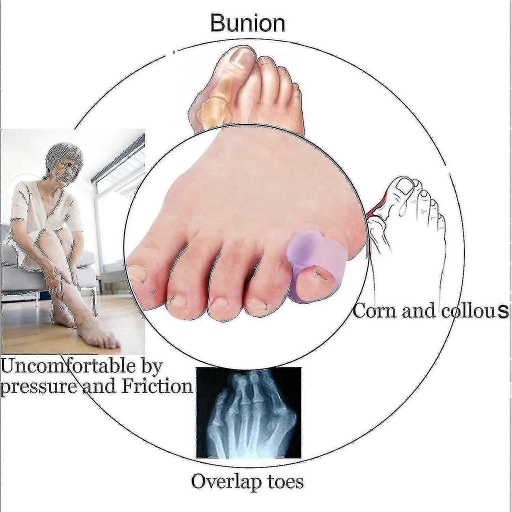 10 Pack Toe Splint, Gel Toe Separator, Toe Straightener Toe