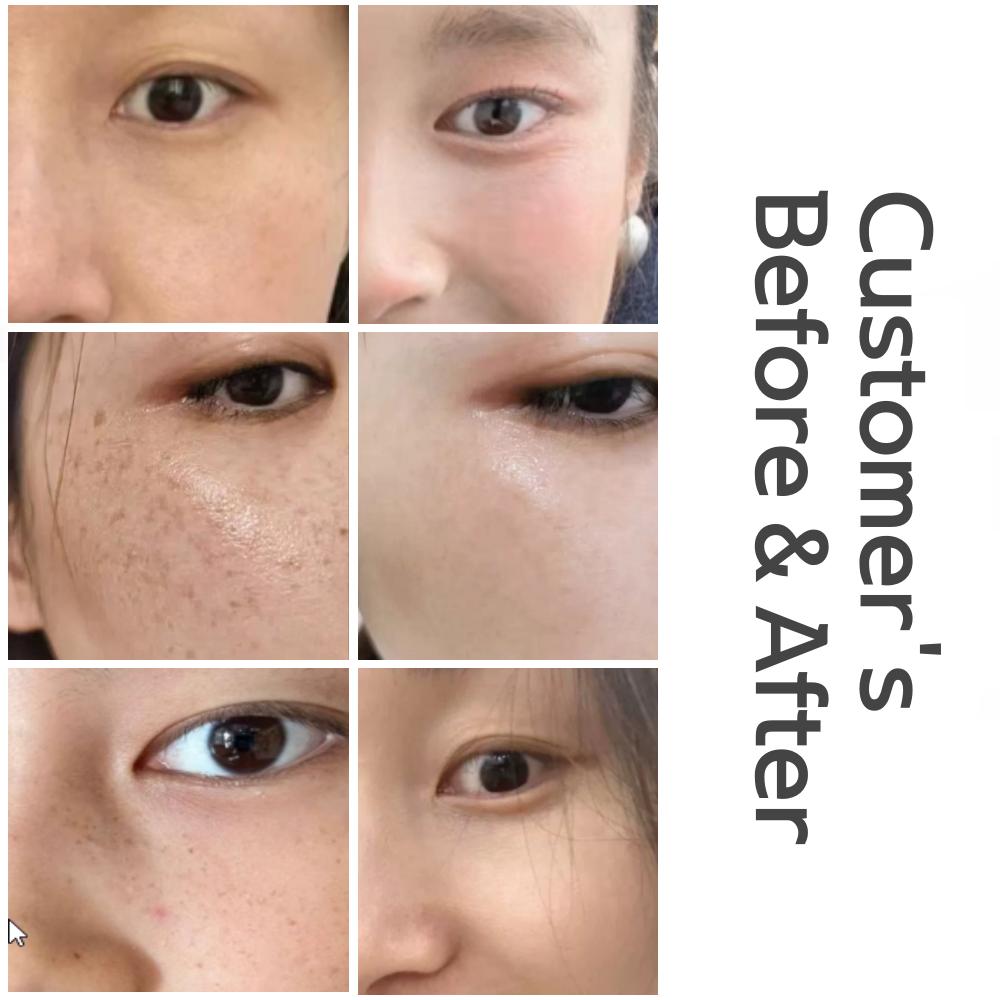 Уономи Осветляющий (Удаление веснушек) Сливки 20г