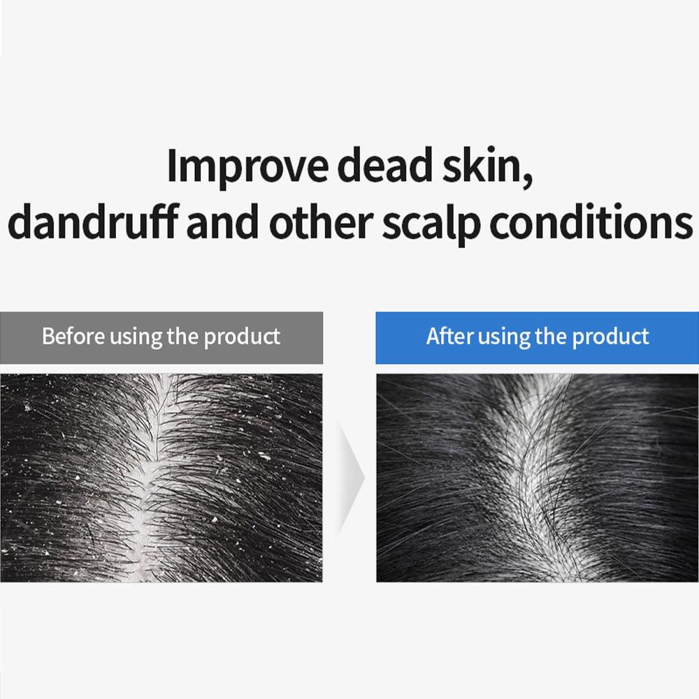 Masil 5 пробиотиков Шампунь для идеального объема 8 мл X 20 шт. Портативный дорожный шампунь для тонких тонких волос, улучшающий шелушение кожи головы, осветляющий шампунь для тусклых волос