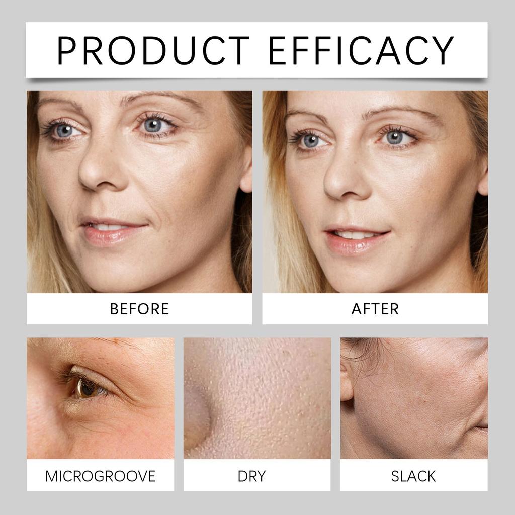 Сыворотка для лица Rose Bright Face Dot Balm Dot Freckle Serum Resist Black Dot Brightening Resist Black Fade Dull 30 мл