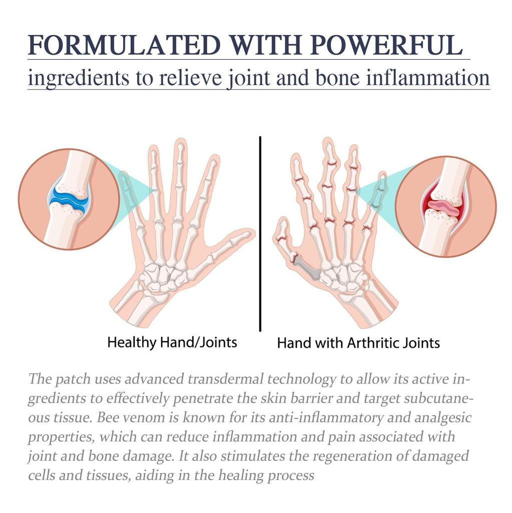 XIMONTH Спрей для суставов с пчелиным ядом, облегчает дискомфорт в суставах и мышцах, расслабляет напряженные и болезненные мышцы, 30 мл