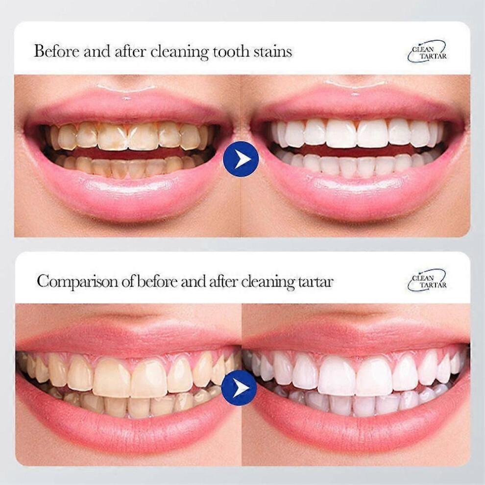 Livfresh Toothpaste Gel, Clinically Proven To Remove Plaque 250% Better less