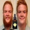 Beard Oils Moisturizing And Repairing Hairy Split Ends Beard Growth Oil For Growth Men Beard Growth