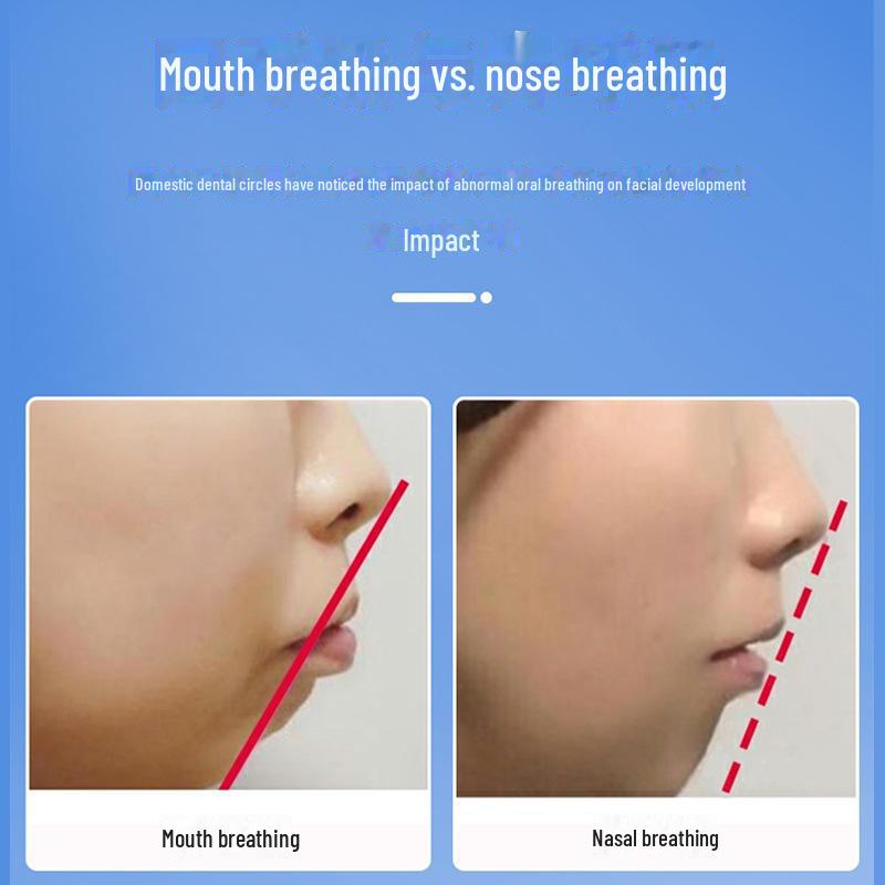 «Наклейки против храпа»: Предотвращает дыхание ртом ночью у взрослых и детей, доставка одним куском"