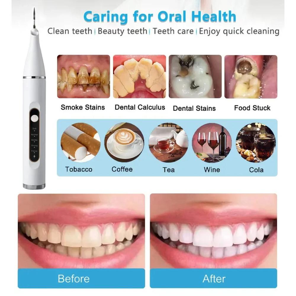 Стоматологический ультразвуковой скалер Электрический очиститель зубов Уход за полостью рта Шпатель для налета удаляет зубной камень Зубной скребок Электрическая зубная щетка